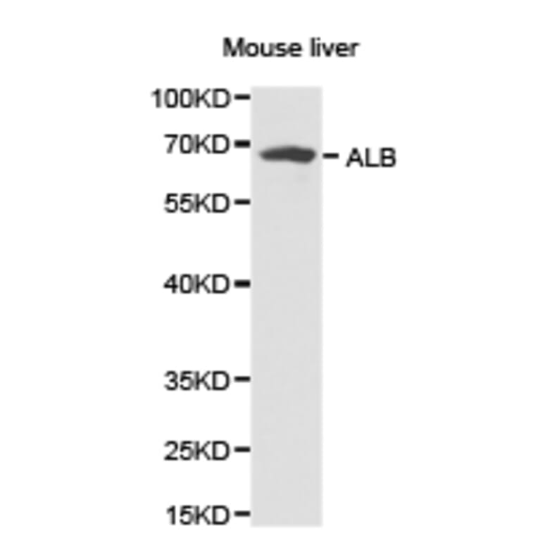 Anti-Albumin Antibody from Bioworld Technology (BS6520) - Antibodies.com