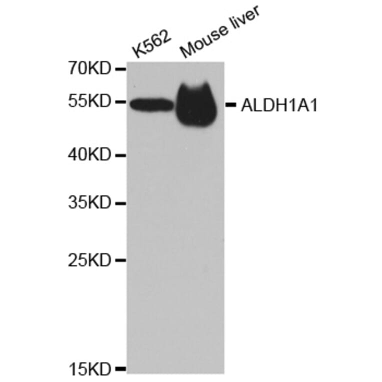 Anti-ALDH1A1 Antibody from Bioworld Technology (BS6521) - Antibodies.com