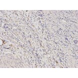 Anti-ALDH1A1 Antibody from Bioworld Technology (BS6521) - Antibodies.com