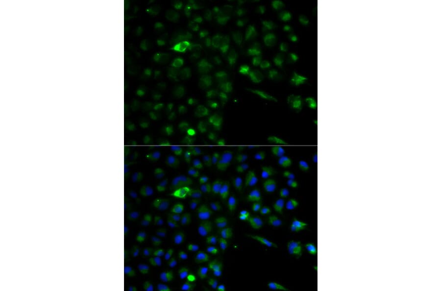 Anti-ALDH1A1 Antibody from Bioworld Technology (BS6521) - Antibodies.com