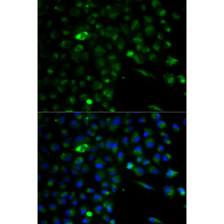 Anti-ALDH1A1 Antibody from Bioworld Technology (BS6521) - Antibodies.com