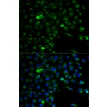 Anti-ALDH1A1 Antibody from Bioworld Technology (BS6521) - Antibodies.com