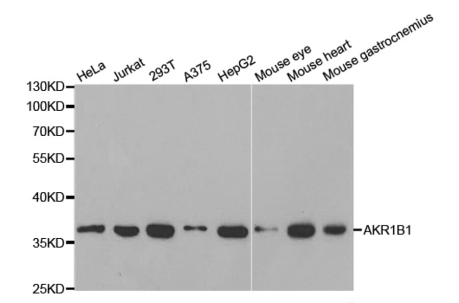 Anti-AKR1B1 Antibody from Bioworld Technology (BS6522) - Antibodies.com