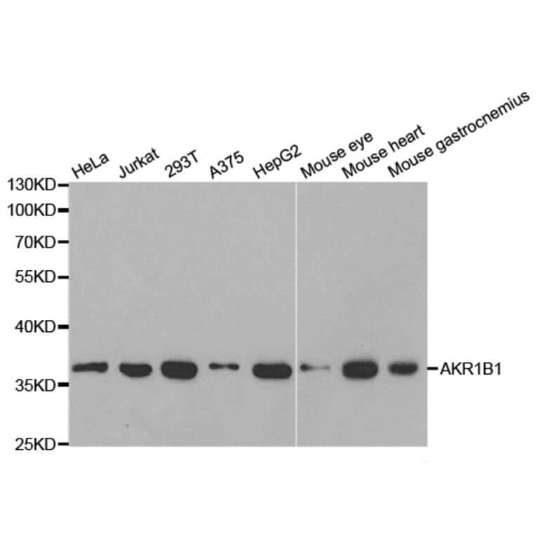 Anti-AKR1B1 Antibody from Bioworld Technology (BS6522) - Antibodies.com