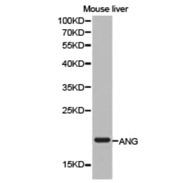 Anti-ANG Antibody from Bioworld Technology (BS6523) - Antibodies.com