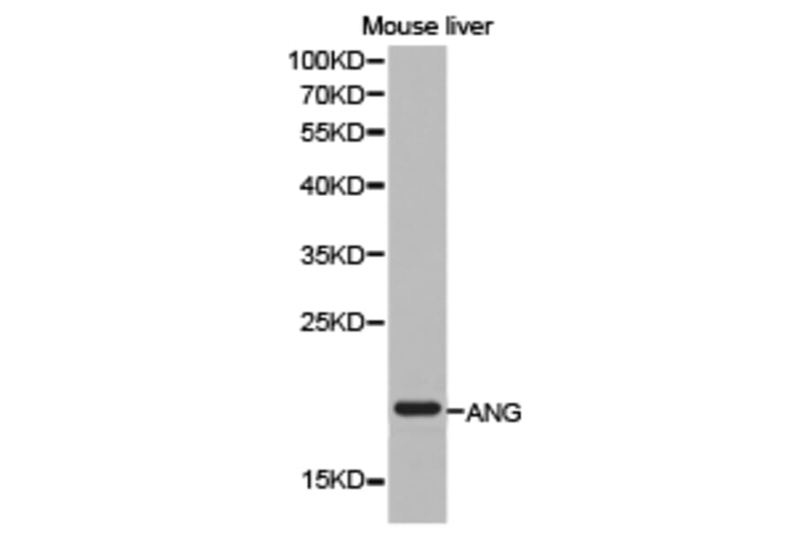 Anti-ANG Antibody from Bioworld Technology (BS6523) - Antibodies.com