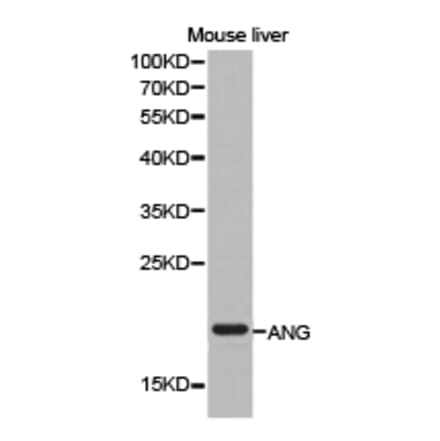 Anti-ANG Antibody from Bioworld Technology (BS6523) - Antibodies.com