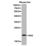 Anti-ANG Antibody from Bioworld Technology (BS6523) - Antibodies.com