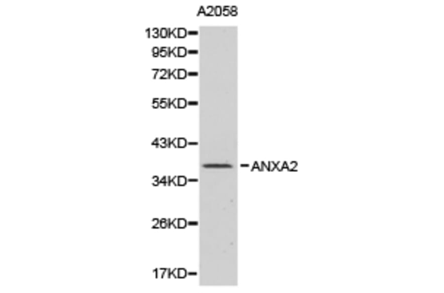 Anti-Annexin 2 Antibody from Bioworld Technology (BS6524) - Antibodies.com