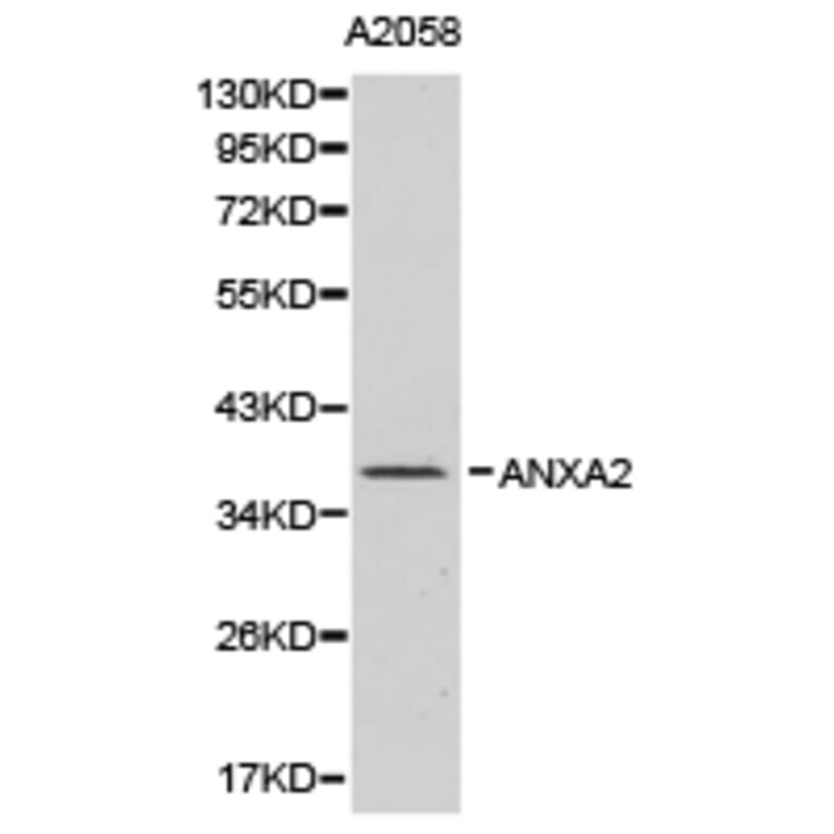 Anti-Annexin 2 Antibody from Bioworld Technology (BS6524) - Antibodies.com