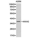 Anti-Annexin 2 Antibody from Bioworld Technology (BS6524) - Antibodies.com