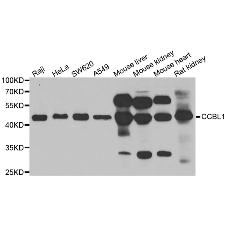 Anti-CCBL1 Antibody from Bioworld Technology (BS6526) - Antibodies.com