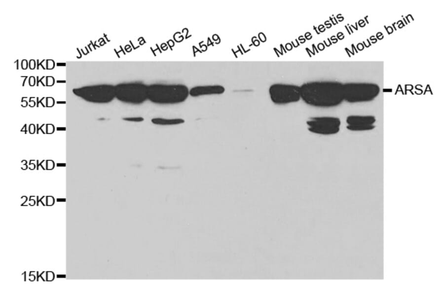 Anti-ARSA Antibody from Bioworld Technology (BS6529) - Antibodies.com