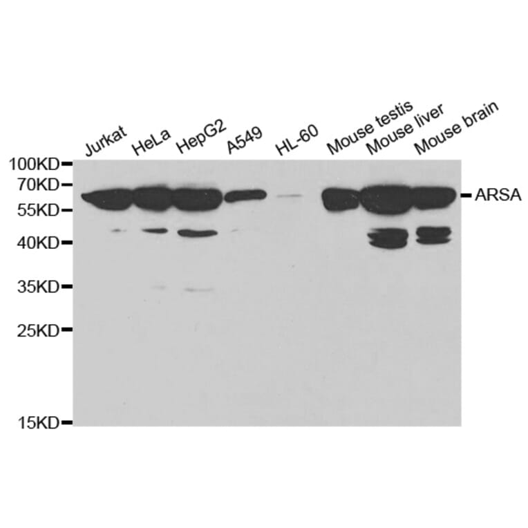 Anti-ARSA Antibody from Bioworld Technology (BS6529) - Antibodies.com