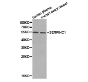 Anti-SERPINC1 Antibody from Bioworld Technology (BS6530) - Antibodies.com
