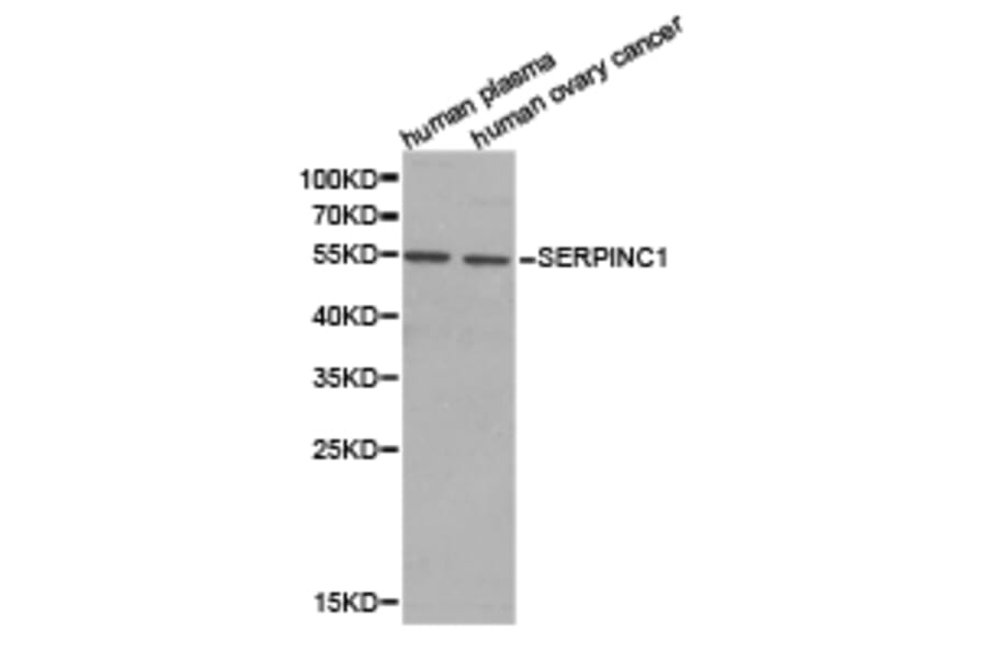 Anti-SERPINC1 Antibody from Bioworld Technology (BS6530) - Antibodies.com