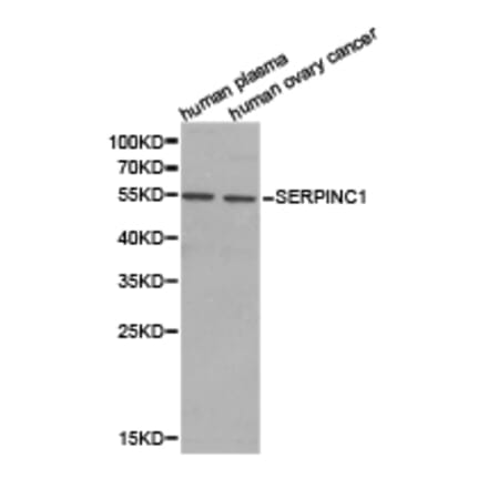 Anti-SERPINC1 Antibody from Bioworld Technology (BS6530) - Antibodies.com