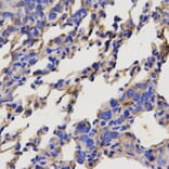 Anti-SERPINC1 Antibody from Bioworld Technology (BS6530) - Antibodies.com