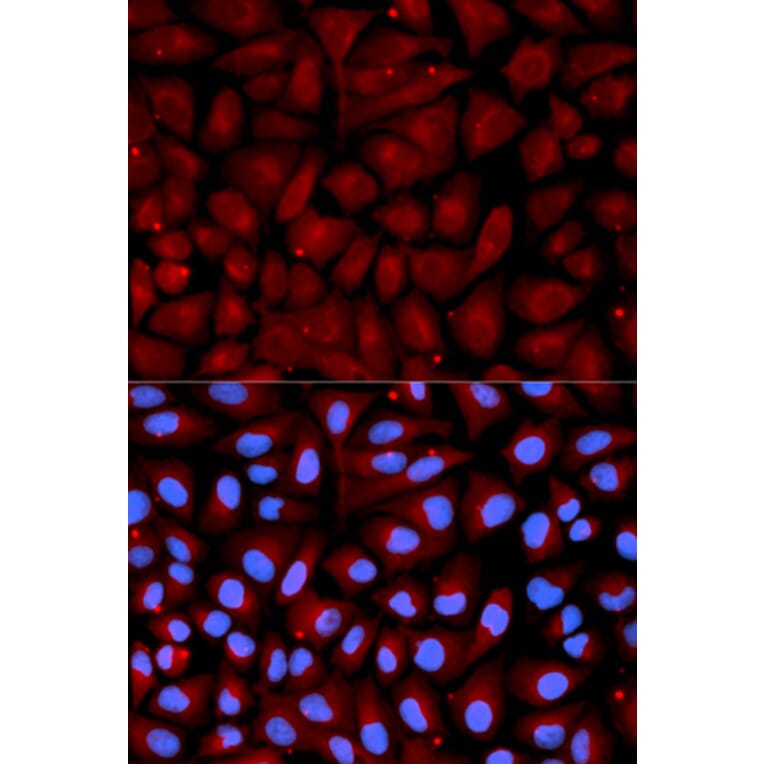 Anti-SERPINC1 Antibody from Bioworld Technology (BS6530) - Antibodies.com