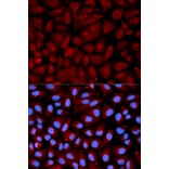 Anti-SERPINC1 Antibody from Bioworld Technology (BS6530) - Antibodies.com