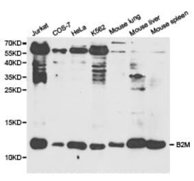 Anti-B2M Antibody from Bioworld Technology (BS6531) - Antibodies.com