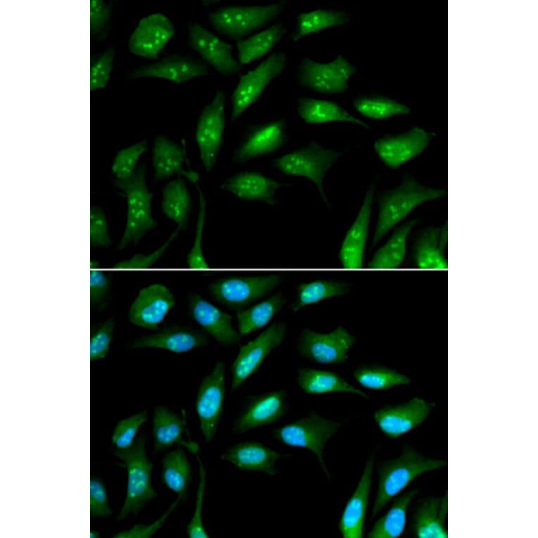 Anti-B2M Antibody from Bioworld Technology (BS6531) - Antibodies.com
