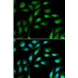 Anti-B2M Antibody from Bioworld Technology (BS6531) - Antibodies.com
