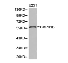 Anti-BMPR1B Antibody from Bioworld Technology (BS6534) - Antibodies.com