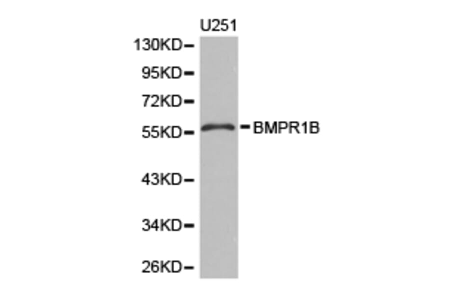 Anti-BMPR1B Antibody from Bioworld Technology (BS6534) - Antibodies.com
