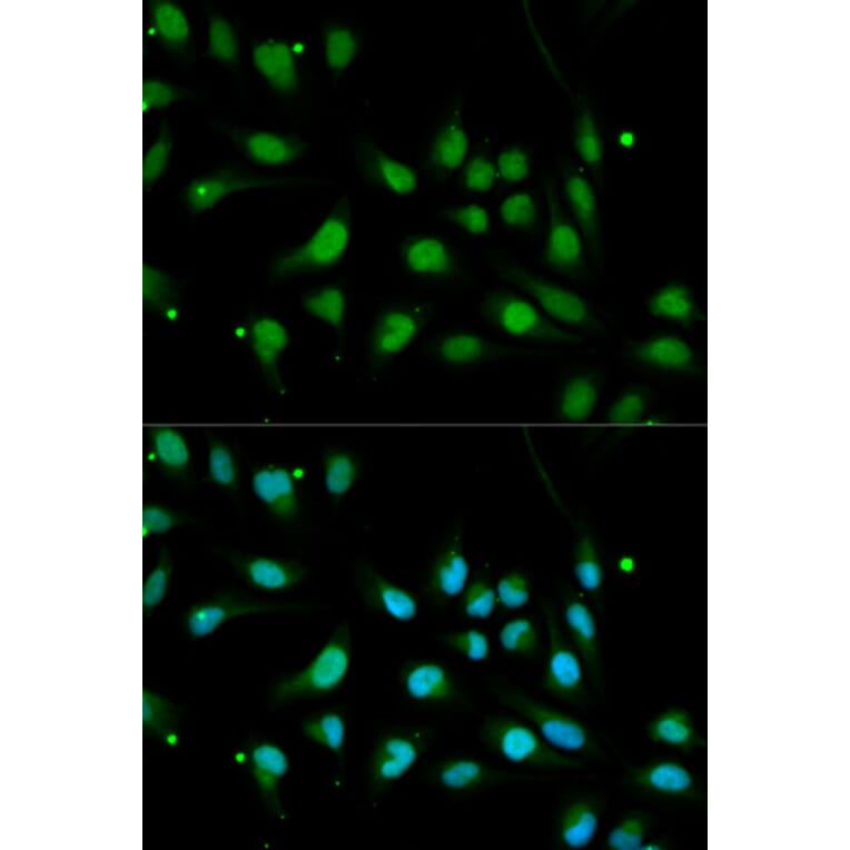 Anti-BMPR1B Antibody from Bioworld Technology (BS6534) - Antibodies.com