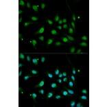 Anti-BMPR1B Antibody from Bioworld Technology (BS6534) - Antibodies.com