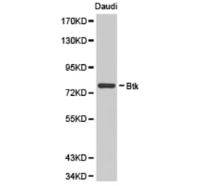 Anti-BTK Antibody from Bioworld Technology (BS6537) - Antibodies.com