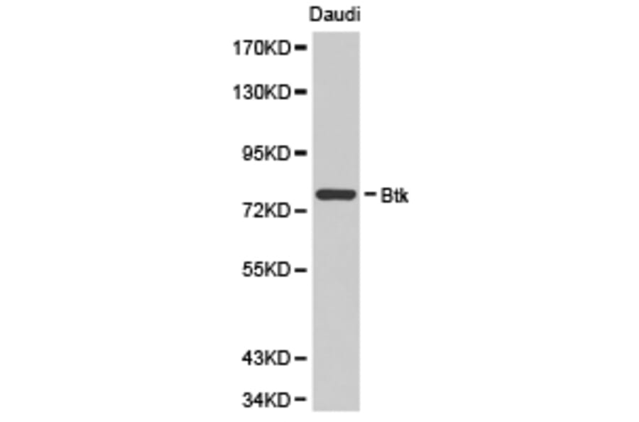 Anti-BTK Antibody from Bioworld Technology (BS6537) - Antibodies.com