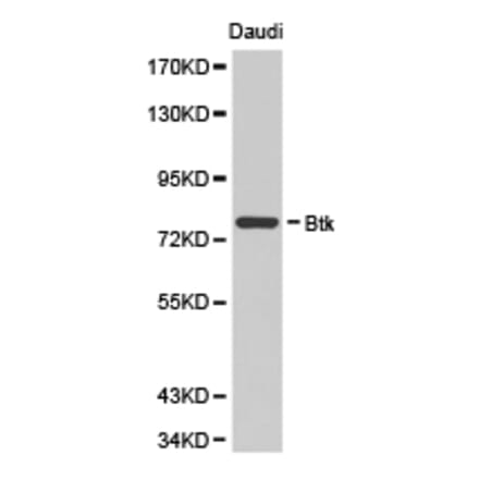 Anti-BTK Antibody from Bioworld Technology (BS6537) - Antibodies.com