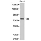Anti-BTK Antibody from Bioworld Technology (BS6537) - Antibodies.com