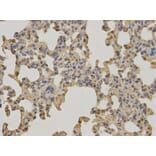 Anti-BTK Antibody from Bioworld Technology (BS6537) - Antibodies.com