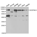 Anti-SERPING1 Antibody from Bioworld Technology (BS6540) - Antibodies.com