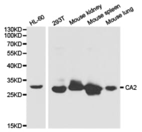 Anti-CA II Antibody from Bioworld Technology (BS6541) - Antibodies.com