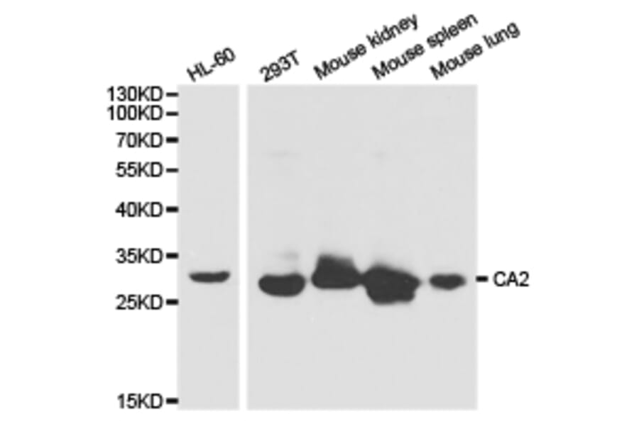 Anti-CA II Antibody from Bioworld Technology (BS6541) - Antibodies.com