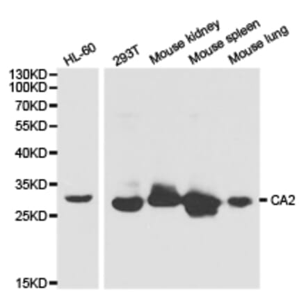 Anti-CA II Antibody from Bioworld Technology (BS6541) - Antibodies.com