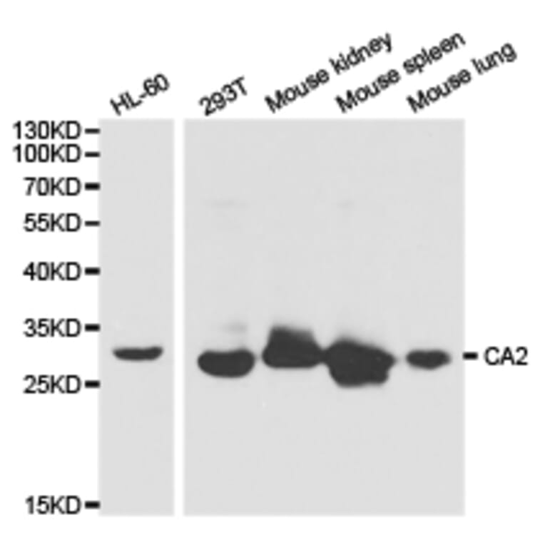 Anti-CA II Antibody from Bioworld Technology (BS6541) - Antibodies.com