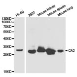 Anti-CA II Antibody from Bioworld Technology (BS6541) - Antibodies.com