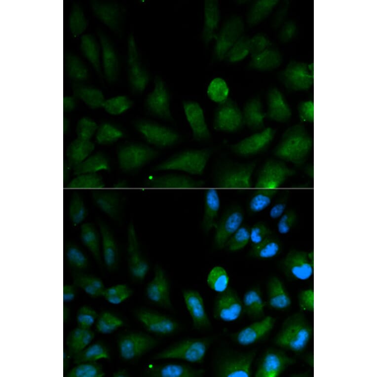 Anti-CAPZA2 Antibody from Bioworld Technology (BS6543) - Antibodies.com