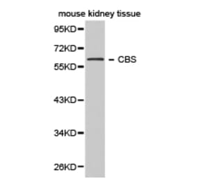 Anti-CBS Antibody from Bioworld Technology (BS6545) - Antibodies.com