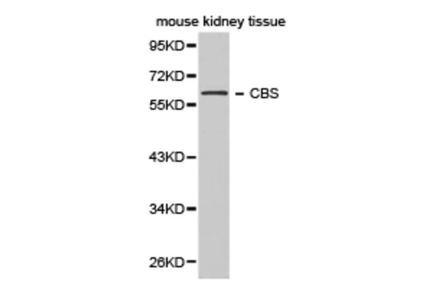 Anti-CBS Antibody from Bioworld Technology (BS6545) - Antibodies.com