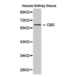 Anti-CBS Antibody from Bioworld Technology (BS6545) - Antibodies.com