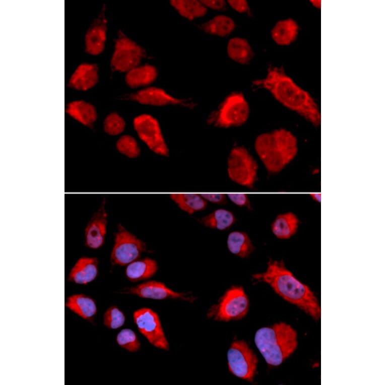 Anti-CBS Antibody from Bioworld Technology (BS6545) - Antibodies.com