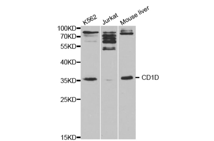 Anti-CD1D Antibody from Bioworld Technology (BS6546) - Antibodies.com