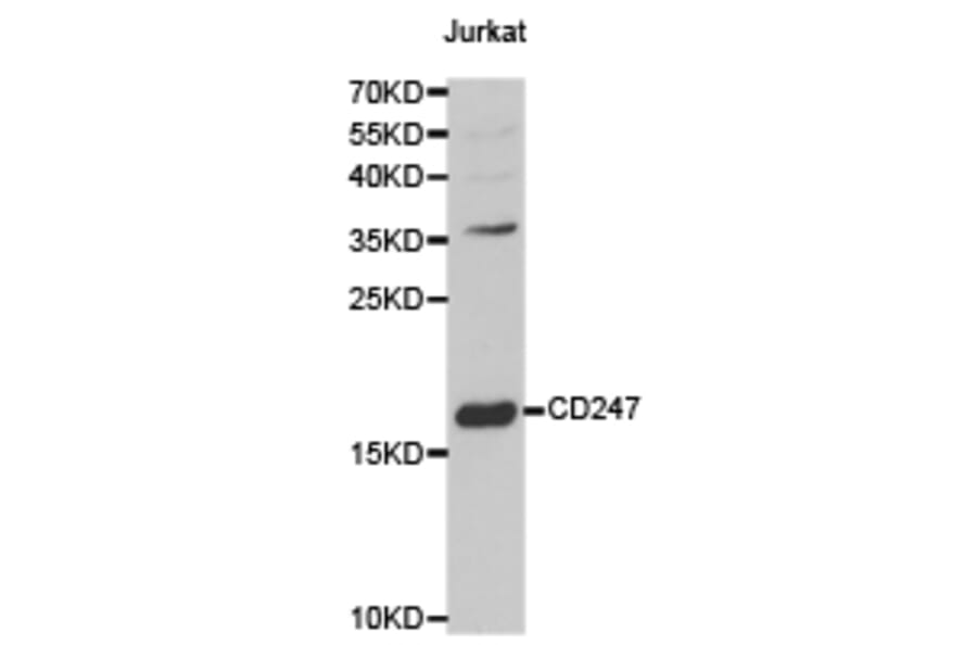 Anti-CD3 ζ Antibody from Bioworld Technology (BS6547) - Antibodies.com