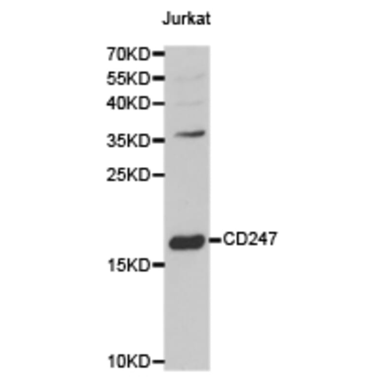 Anti-CD3 ζ Antibody from Bioworld Technology (BS6547) - Antibodies.com